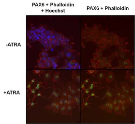 PAX6 antibody