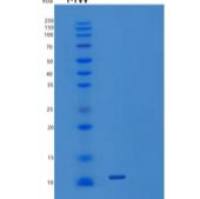 人激活素受体1B/激活素RIB/ALK-4/ACVR1B重组蛋白C-6His