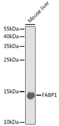 L-FABP antibody