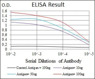 Cytokeratin 5 antibody [2C2B4]