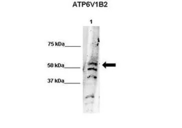 ATP6V1B2 antibody, N-term