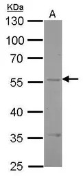 Endothelin B Receptor antibody