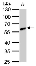 CLN3 antibody