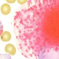 酸性磷酸酶染色服务