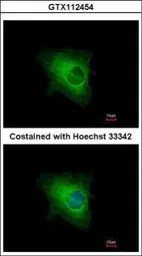 Cytokeratin 33B antibody
