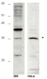 HUS1B antibody