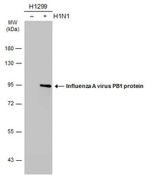 Influenza A virus PB1 protein 