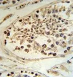 DEK antibody, C-term