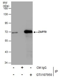 ZAP70 antibody