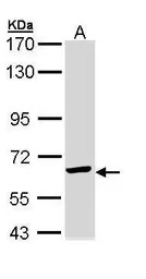 TCP1 epsilon antibody [N1C1]