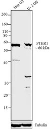 PTH1R antibody