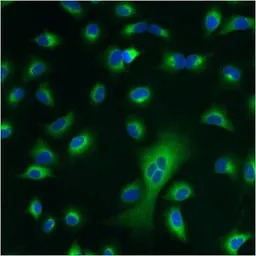 PDI antibody [RL77]