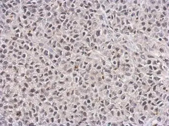 TET1 antibody [GT1462]