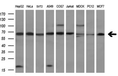 Transketolase antibody [5H3]