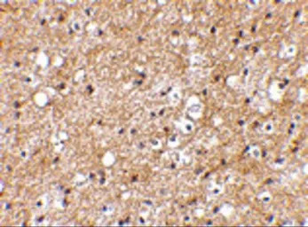 SP110 antibody