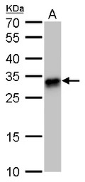 HLA-DQB1 antibody