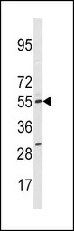 CYP11A1 antibody, N-term