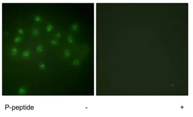 Vitamin D Receptor (phospho Se