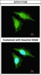 SMAD2 / SMAD3 antibody