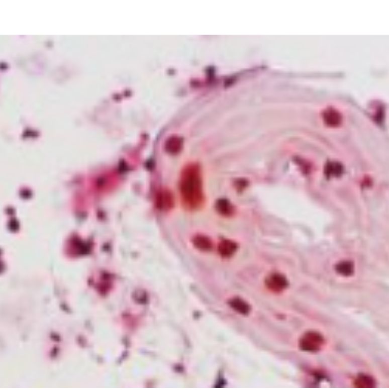 β-半乳糖苷酶染色