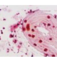 β-半乳糖苷酶染色