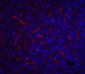 Apolipoprotein A1 antibody