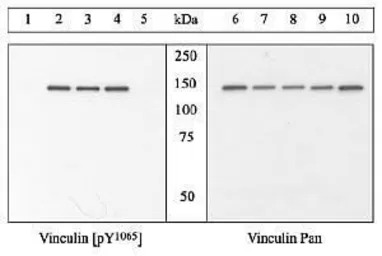Vinculin (phospho Tyr1065) ant