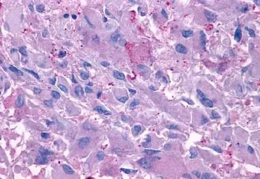 Glucagon receptor antibody