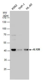 IL12B / IL12 p40 antibody