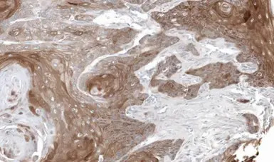 Thymidine Phosphorylase antibo