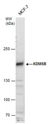KDM5B antibody