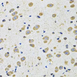 EphA2 antibody