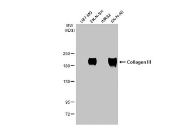 Collagen III antibody [C2C3], 