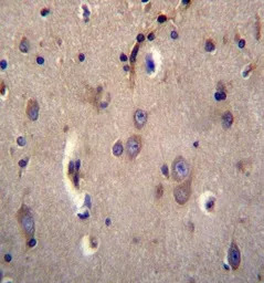 Dystrobrevin alpha antibody