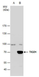 TIGD1 antibody [C3], C-term