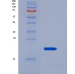 小鼠碱性成纤维细胞生长因子(FGF2)重组蛋白