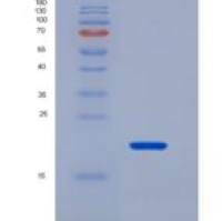 小鼠碱性成纤维细胞生长因子(FGF2)重组蛋白