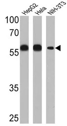 PDI antibody [RL77]