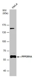 PPP2R1A antibody