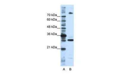 FUSIP1 antibody, C-term