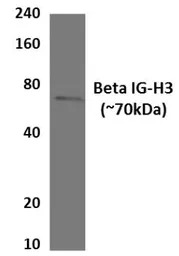 TGFBI antibody [30G12]