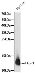 L-FABP antibody