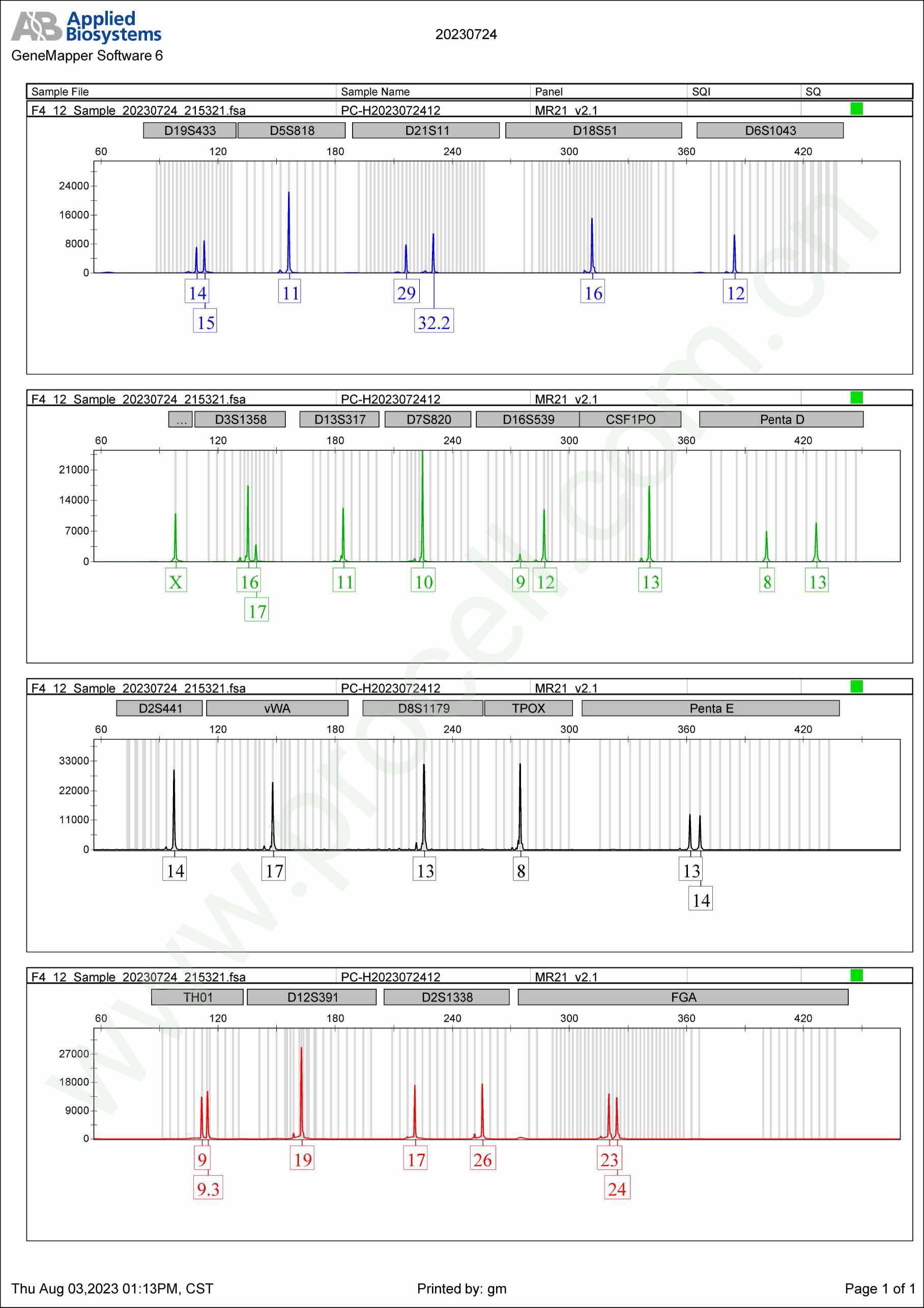Hs 578T(人乳腺癌细胞)