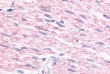 alpha 2c Adrenergic Receptor a