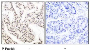 ELK1 (phospho Thr417) antibody