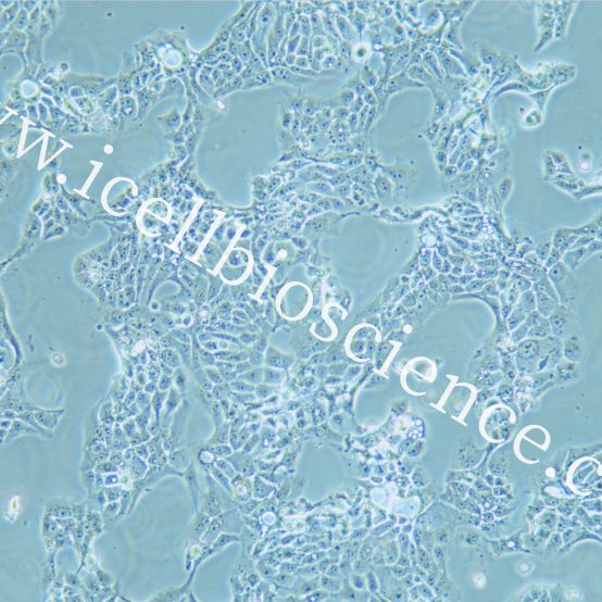 CAL33细胞、CAL-33细胞、CAL-33、CAL33、人舌磷癌细胞/STR鉴定/镜像绮点(Cellverse)