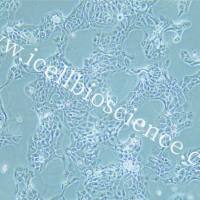 CAL33细胞、CAL-33细胞、CAL-33、CAL33、人舌磷癌细胞/STR鉴定/镜像绮点