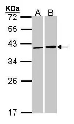 Fibrillarin antibody