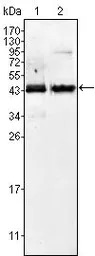 AMACR antibody [2A10F3]