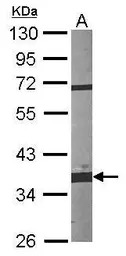Fibrillarin antibody